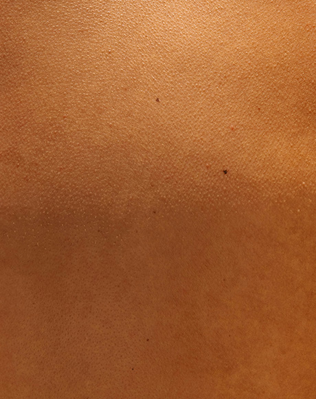 A close up of skin